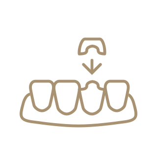 Dental Crown in Beverly Hills, CA Dental Crown in Beverly Hills, CA