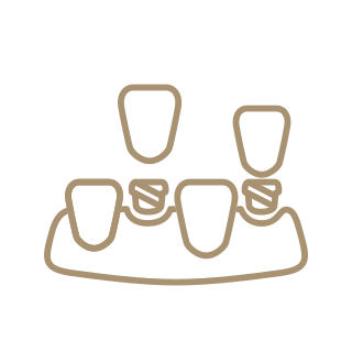 Illustration of dental implants supporting replacement teeth  Minimalist line icon showing three dental implants integrated with jawbone to support artificial teeth