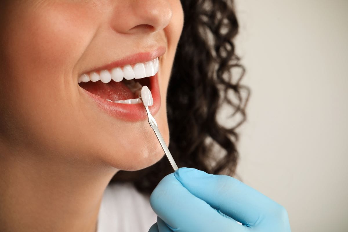 Smiling woman undergoing a shade-matching process for dental veneers, with a gloved hand holding a veneer sample near her teeth.