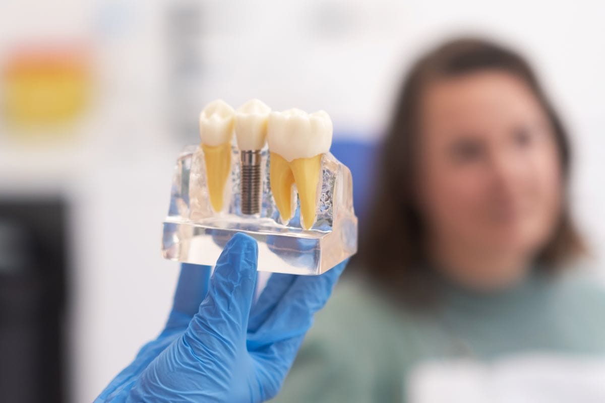 Gloved hand holding a clear model of a dental implant with crowns, showing implant placement to a patient in a dental consultation setting.