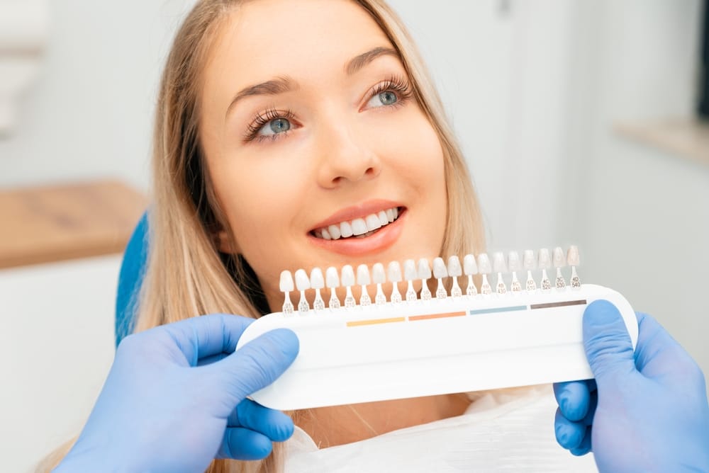 Patient smile matched with tooth shade guide – Veneers Los Angeles Blonde woman smiling during tooth color match at cosmetic appointment – Veneers Los Angeles