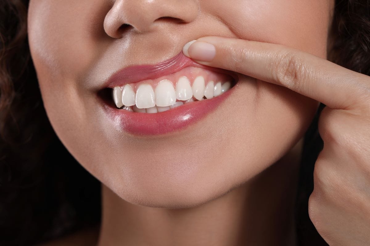 Close-up of a woman lifting her upper lip to reveal clean teeth and healthy gums, showing results of a professional dental cleaning.